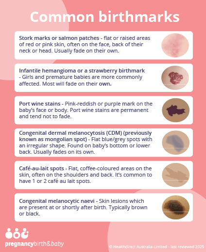 Common birthmarks.