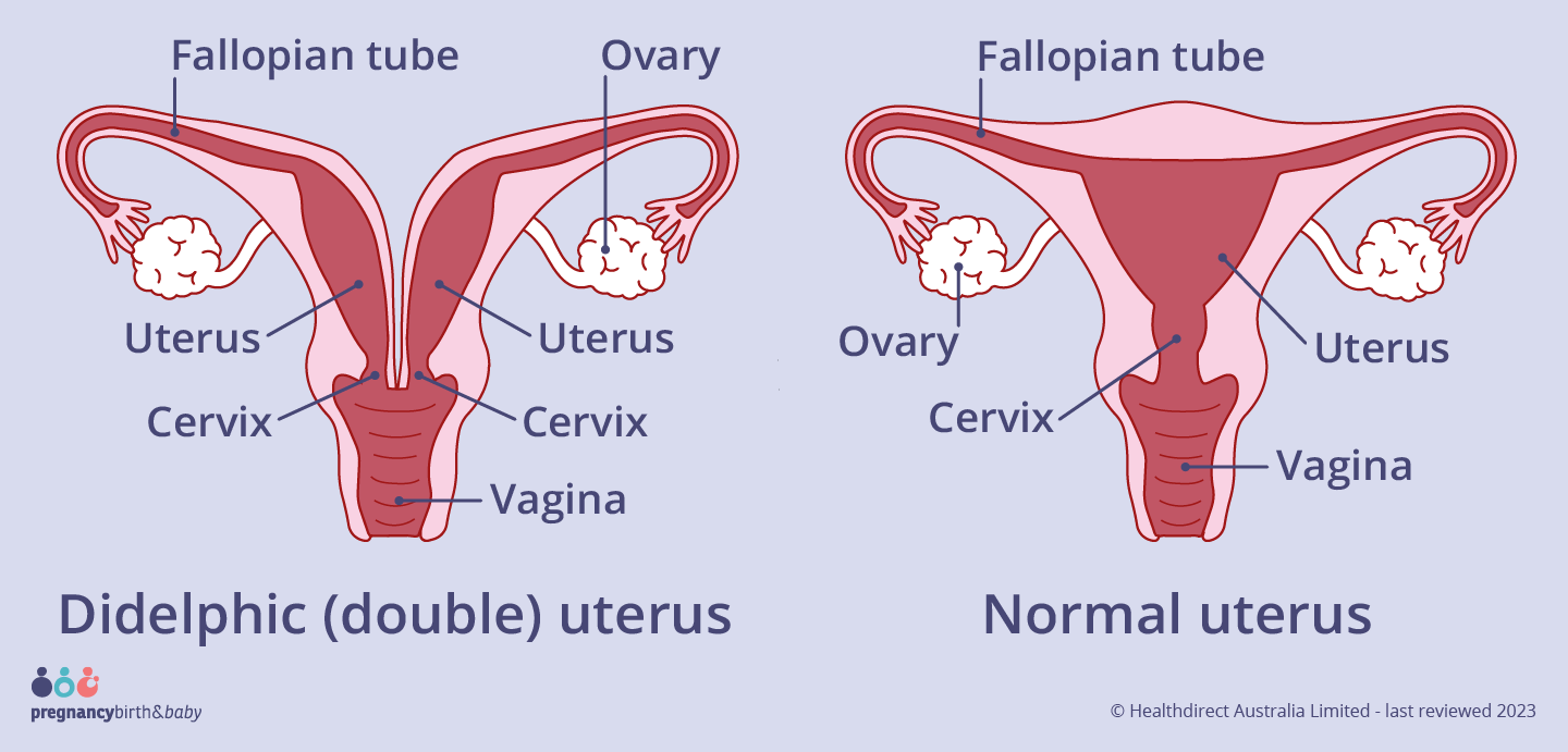 If your uterus is didelphic, it means that uterus womb is split in two.