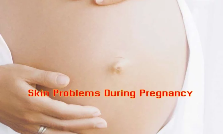skin problems during pregnancy
