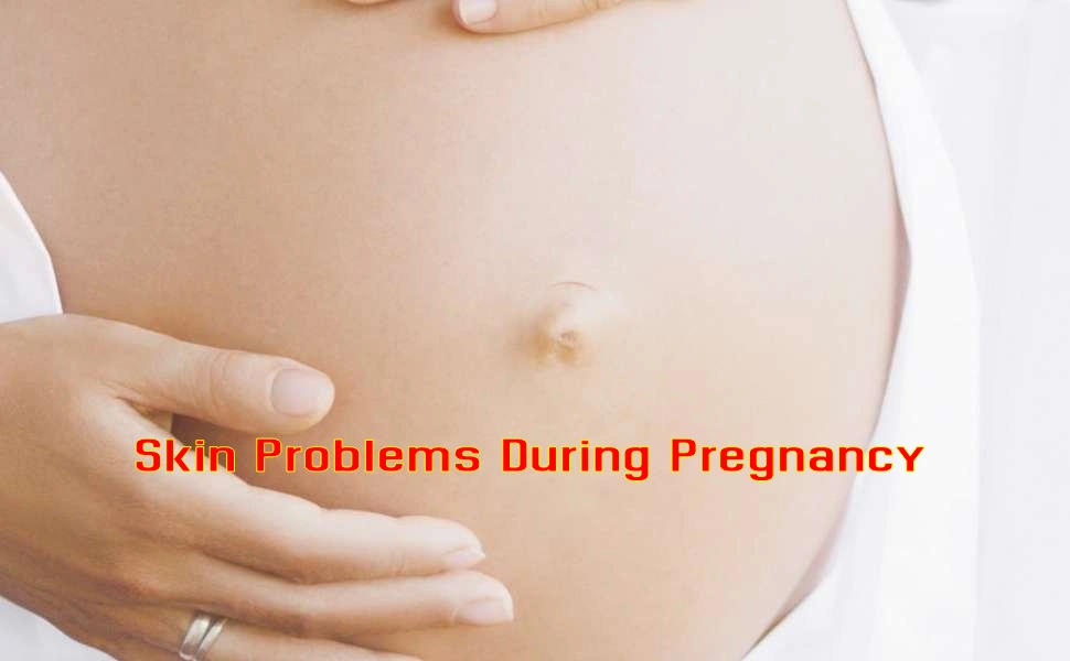 skin problems during pregnancy