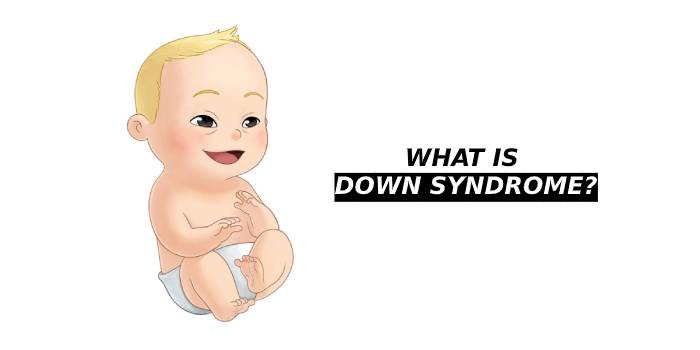 Down Syndrome